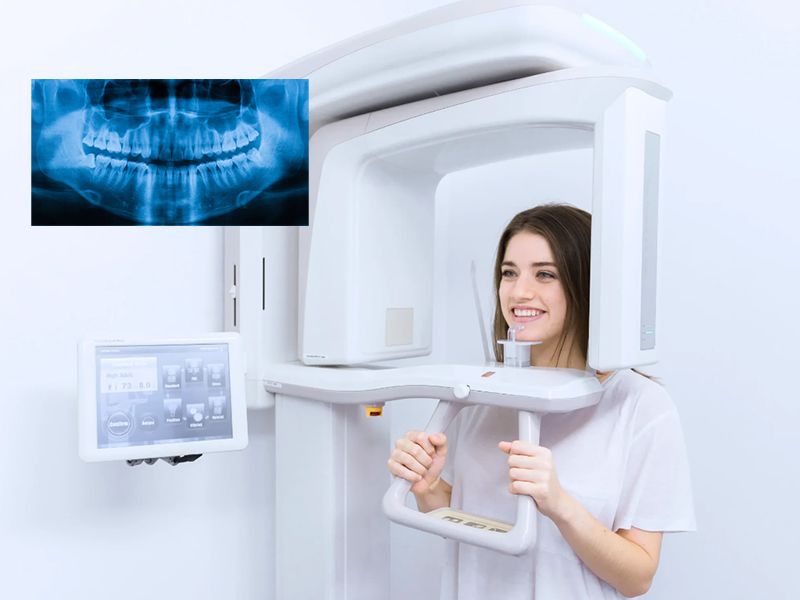 OPG (Full mouth) X Ray