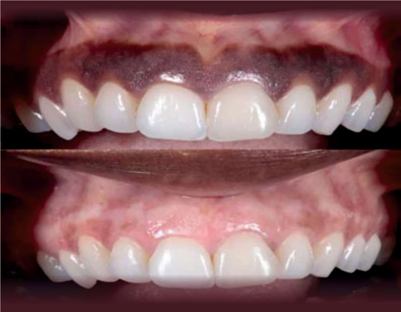 Preventive Dentistry