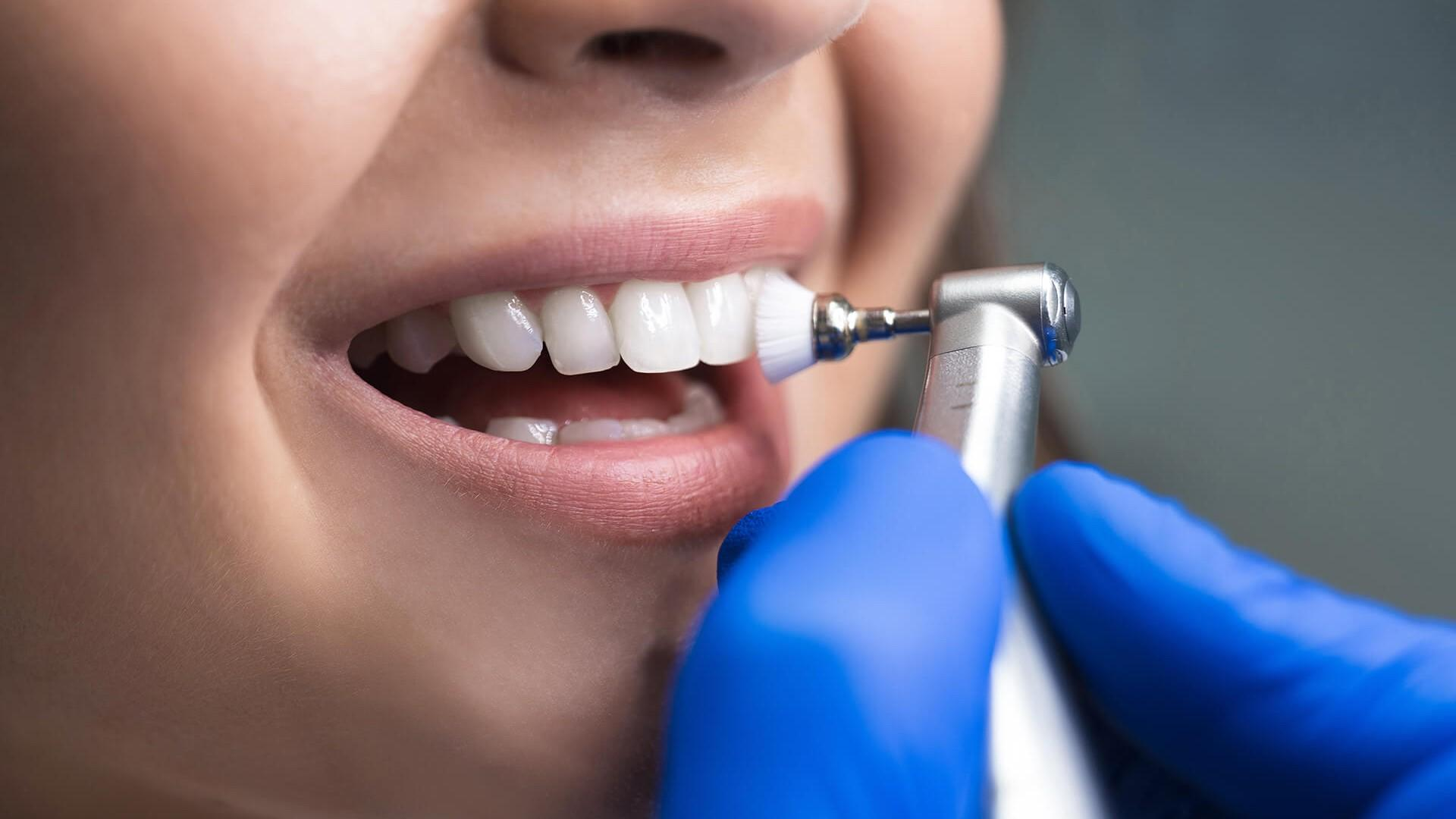 Preventive Dentistry